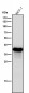 Anti-AKR1C3 Rabbit Monoclonal Antibody